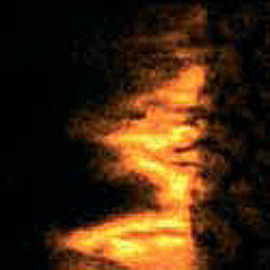 Oleic Acid image of ion map of mouse leg: Duchenne Muscular Dystrophy Lipids